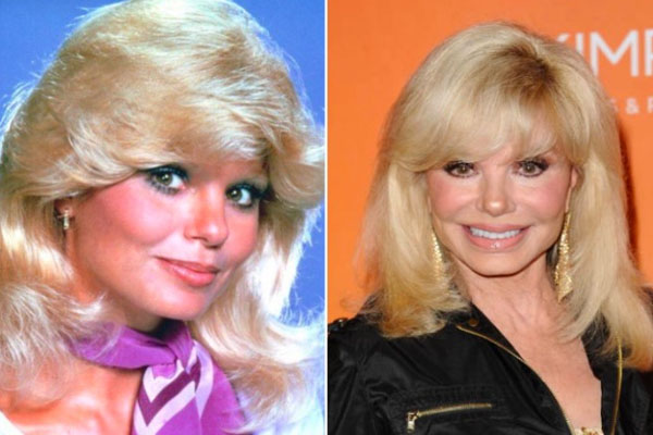 Loni Anderson