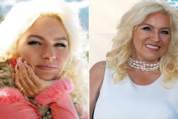 Beth Chapman