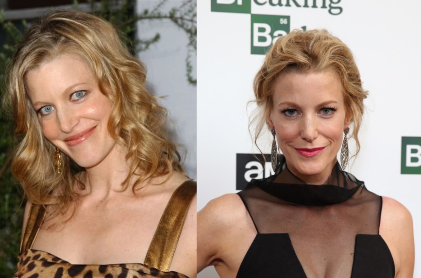 Anna Gunn