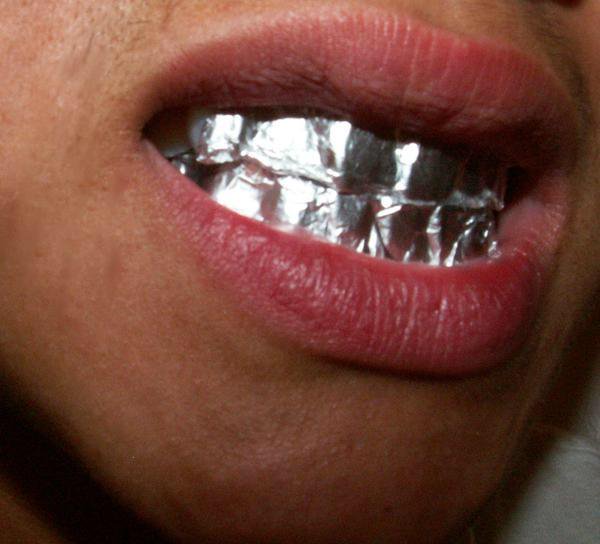 Foil Wrapped Teeth