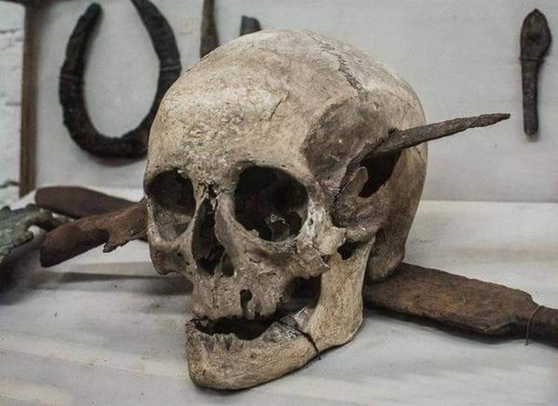 Skull Of Roman Legionnaire Killed In The Gallic Wars